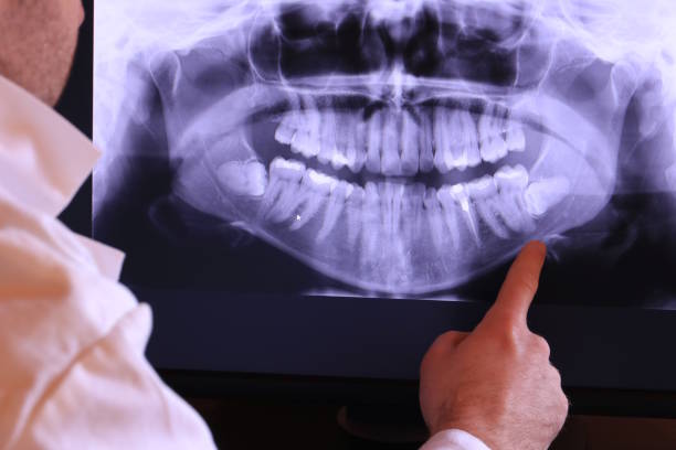 Best Broken or Chipped Tooth Repair in Peach Springs, AZ